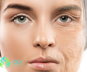 טיפול מזותרפיה ללא מחטים: מהפכה בטיפולי טיפוח העור